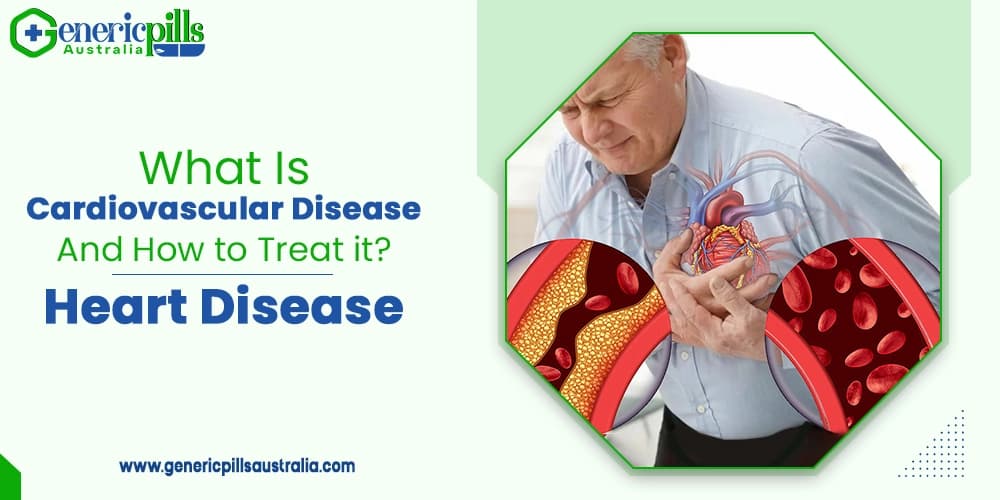 What Is Cardiovascular Disease and How to Treat it? | Heart Disease |